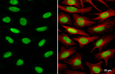 Anti-RCC1 antibody [HL6011] used in Immunocytochemistry/ Immunofluorescence (ICC/IF). GTX648085