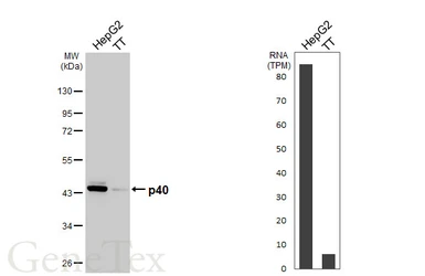 Anti-p40 antibody [HL6012] used in Western Blot (WB). GTX648086
