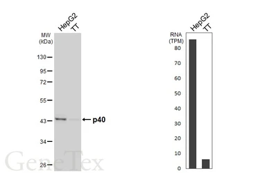 Anti-p40 antibody [HL6013] used in Western Blot (WB). GTX648087