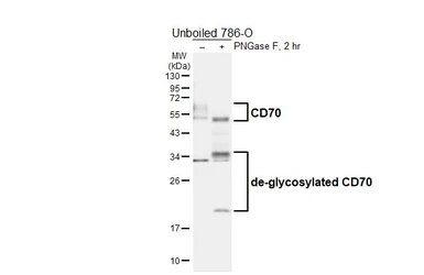 Anti-CD70 antibody [HL6015] used in Western Blot (WB). GTX648089