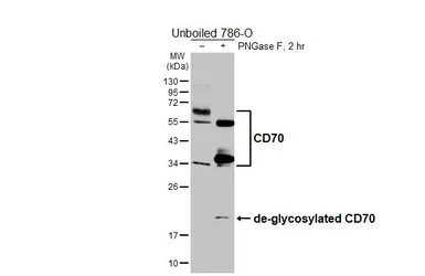 Anti-CD70 antibody [HL6015] used in Western Blot (WB). GTX648089