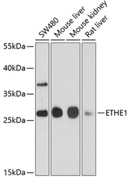 Anti-ETHE1 antibody used in Western Blot (WB). GTX64809