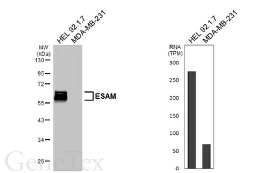 Anti-ESAM antibody [HL6024] used in Western Blot (WB). GTX648098
