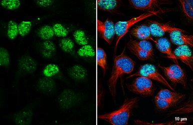 Anti-E2F3 antibody [HL6027] used in Immunocytochemistry/ Immunofluorescence (ICC/IF). GTX648101