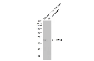 Anti-E2F3 antibody [HL6027] used in Western Blot (WB). GTX648101