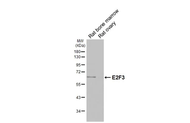 Anti-E2F3 antibody [HL6027] used in Western Blot (WB). GTX648101