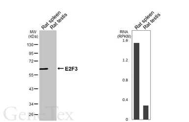 Anti-E2F3 antibody [HL6027] used in Western Blot (WB). GTX648101