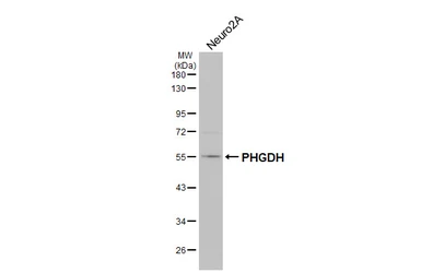 Anti-PHGDH antibody [HL6028] used in Western Blot (WB). GTX648102