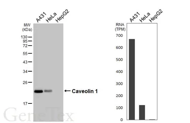 Anti-Caveolin 1 antibody [HL6038] used in Western Blot (WB). GTX648112