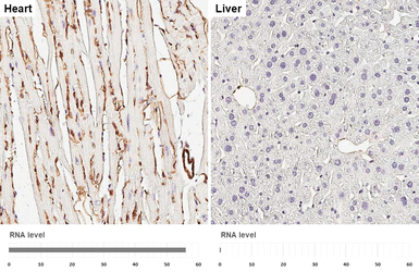Anti-Caveolin 1 antibody [HL6039] used in IHC (Paraffin sections) (IHC-P). GTX648113