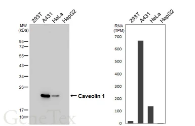 Anti-Caveolin 1 antibody [HL6039] used in Western Blot (WB). GTX648113