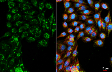 Anti-FLRT3 antibody [GT396] used in Immunocytochemistry/ Immunofluorescence (ICC/IF). GTX648115