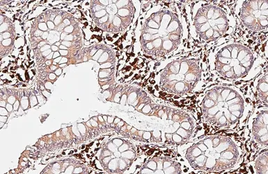 Anti-PSAP antibody [HL6041] used in IHC (Paraffin sections) (IHC-P). GTX648120