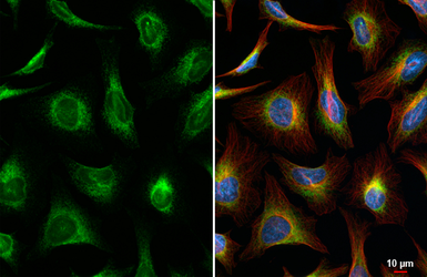 Anti-SEC61B antibody [HL6048] used in Immunocytochemistry/ Immunofluorescence (ICC/IF). GTX648127