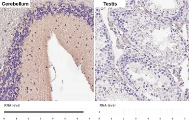 Anti-RAB39B antibody [HL6059] used in IHC (Paraffin sections) (IHC-P). GTX648138