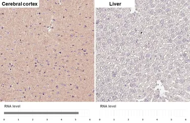 Anti-RAB39B antibody [HL6059] used in IHC (Paraffin sections) (IHC-P). GTX648138