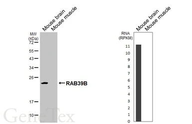 Anti-RAB39B antibody [HL6059] used in Western Blot (WB). GTX648138