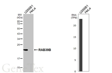 Anti-RAB39B antibody [HL6059] used in Western Blot (WB). GTX648138