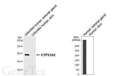 Anti-CYP21A2 antibody [HL6072] used in Western Blot (WB). GTX648151