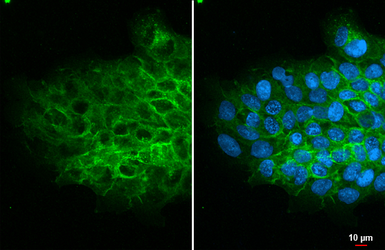 Anti-TACSTD2 antibody [HL6077] used in Immunocytochemistry/ Immunofluorescence (ICC/IF). GTX648156