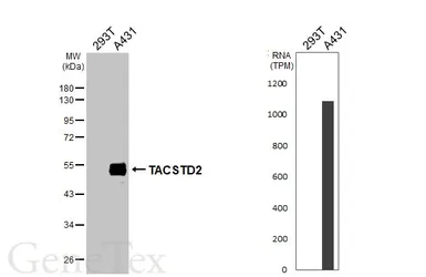 Anti-TACSTD2 antibody [HL6077] used in Western Blot (WB). GTX648156