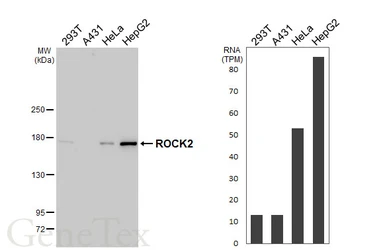 Anti-ROCK2 antibody [HL6078] used in Western Blot (WB). GTX648157