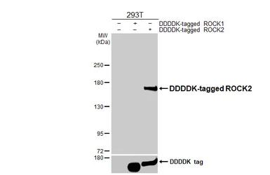 Anti-ROCK2 antibody [HL6078] used in Western Blot (WB). GTX648157