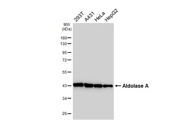Anti-Aldolase A antibody [HL6080] used in Western Blot (WB). GTX648159