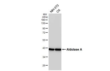 Anti-Aldolase A antibody [HL6080] used in Western Blot (WB). GTX648159