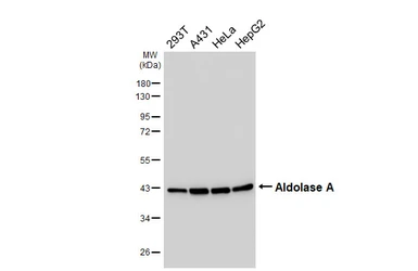 Anti-Aldolase A antibody [HL6082] used in Western Blot (WB). GTX648161
