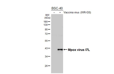 Anti-Mpox virus I7L antibody [GT400] used in Western Blot (WB). GTX648165