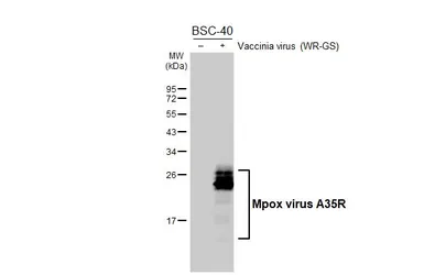 Anti-Mpox virus A35R antibody [GT401] used in Western Blot (WB). GTX648166