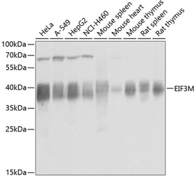 Anti-PCID1 antibody used in Western Blot (WB). GTX64817