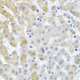 Anti-PCID1 antibody used in IHC (Paraffin sections) (IHC-P). GTX64817