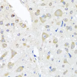 Anti-PCID1 antibody used in IHC (Paraffin sections) (IHC-P). GTX64817