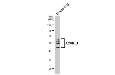Anti-ACVRL1 antibody [HL6091] used in Western Blot (WB). GTX648176