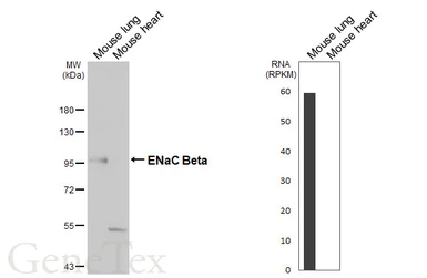 Anti-ENaC Beta antibody [HL6092] used in Western Blot (WB). GTX648177