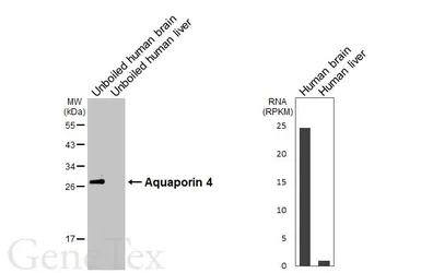 Anti-Aquaporin 4 antibody [HL6096] used in Western Blot (WB). GTX648181