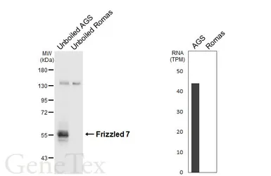 Anti-Frizzled 7 antibody [HL6104] used in Western Blot (WB). GTX648189
