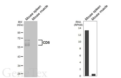 Anti-CD5 antibody [HL6108] used in Western Blot (WB). GTX648193