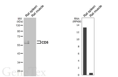 Anti-CD5 antibody [HL6108] used in Western Blot (WB). GTX648193