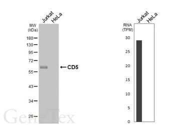 Anti-CD5 antibody [HL6108] used in Western Blot (WB). GTX648193