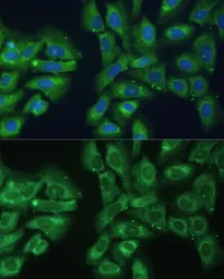 Anti-EIF3D antibody used in Immunocytochemistry/ Immunofluorescence (ICC/IF). GTX64820