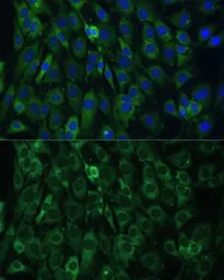 Anti-EIF3D antibody used in Immunocytochemistry/ Immunofluorescence (ICC/IF). GTX64820