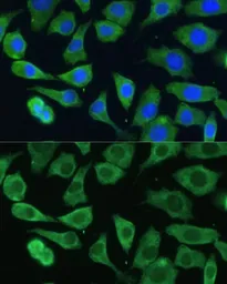 Anti-EIF3D antibody used in Immunocytochemistry/ Immunofluorescence (ICC/IF). GTX64820