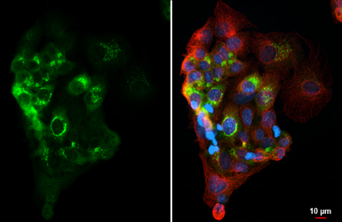 Anti-Alpha fetoprotein / AFP antibody [HL6119] used in Immunocytochemistry/ Immunofluorescence (ICC/IF). GTX648204