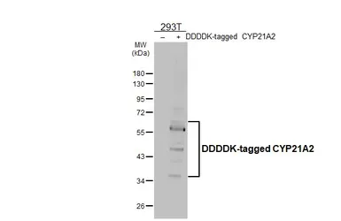 Anti-CYP21A2 antibody [HL6124] used in Western Blot (WB). GTX648209