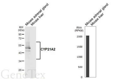 Anti-CYP21A2 antibody [HL6124] used in Western Blot (WB). GTX648209