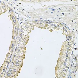 Anti-ANKH antibody used in IHC (Paraffin sections) (IHC-P). GTX64821