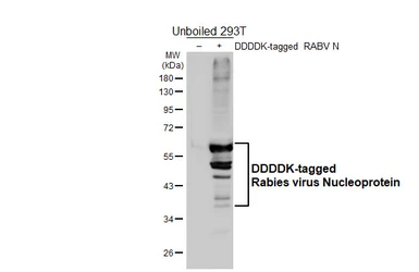 Anti-Rabies virus Nucleoprotein antibody [HL6156] used in Western Blot (WB). GTX648243